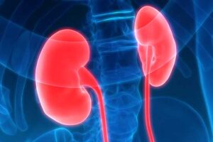 Hypertensive-Kidney-Disease